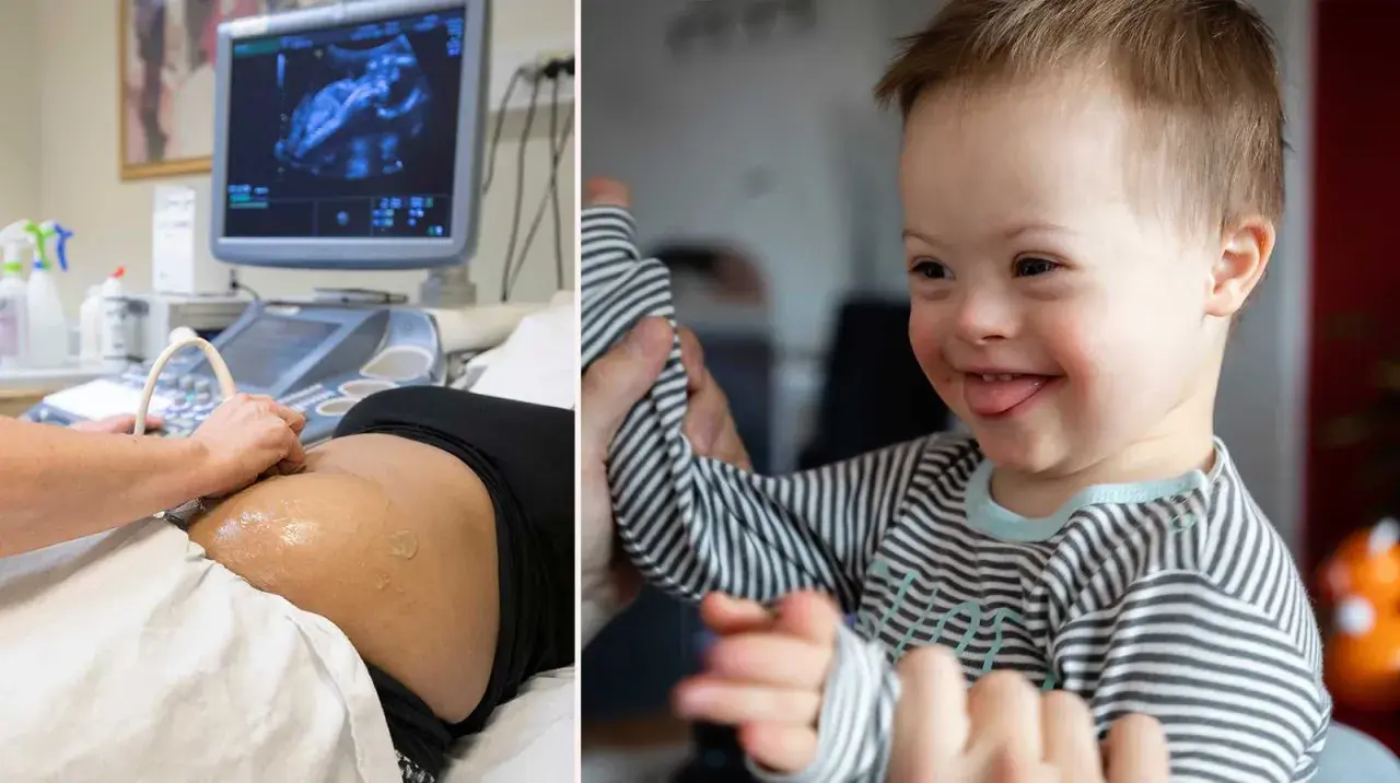 Graviditet och ultraljud till höger en glad pojke med Downs syndrom. Kan två med Downs syndrom få ett friskt barn?