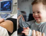 Graviditet och ultraljud till höger en glad pojke med Downs syndrom. Kan två med Downs syndrom få ett friskt barn?