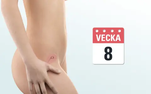 Bild visar en graviditet i vecka 8. En illustration av livmodern visar ett tidigt foster.
