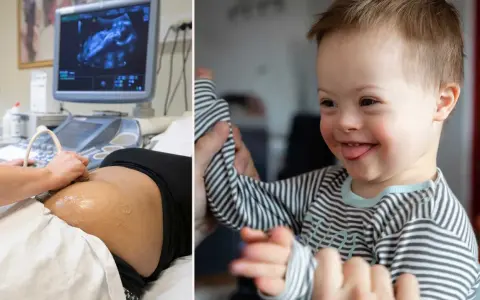 Graviditet och ultraljud till höger en glad pojke med Downs syndrom. Kan två med Downs syndrom få ett friskt barn?