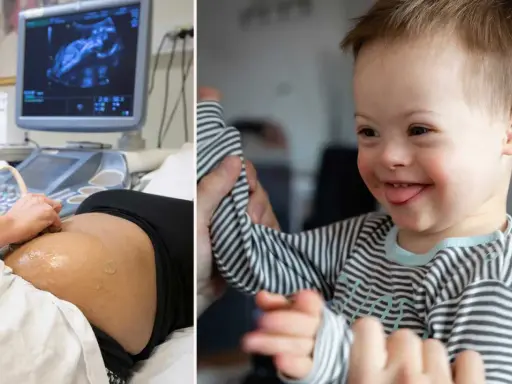 Graviditet och ultraljud till höger en glad pojke med Downs syndrom. Kan två med Downs syndrom få ett friskt barn?