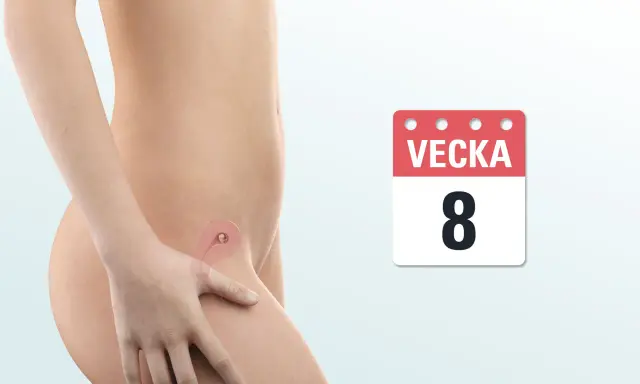 Bild visar en graviditet i vecka 8. En illustration av livmodern visar ett tidigt foster.